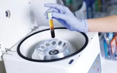 Prinsip Kerja Centrifuge dan Fungsinya di Laboratorium